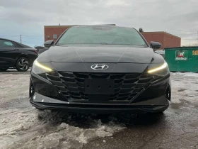 Hyundai Elantra Ultimate CARFAX - 17500 € / 34227.03 лв. - 21245317 6 | Car24.bg Hyundai Elantra Ultimate CARFAX - 17500 € / 34227.03 лв. - 21245317 6