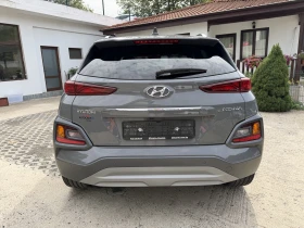 Hyundai Kona 1.6CRDI Нави.Кожа. - 11900 € - 20050190 5 | Car24.bg Hyundai Kona 1.6CRDI Нави.Кожа. - 11900 € - 20050190 5