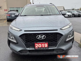Hyundai Kona - 11100 € - 79251824 6