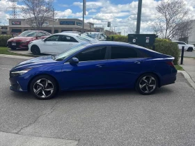 Hyundai Elantra * Ultimate Tech * CARFAX * ШИБИДАХ * KEYLESS * , снимка 2