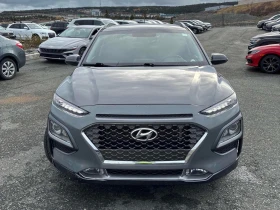 Hyundai Kona * Trend * CARFAX * БЕЗ ПЪРВОНАЧАЛНА ВНОСКА - 33100 лв. / 16923.76 € - 76967565 6