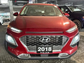 Hyundai Kona * Ultimate * CARFAX * ЦЕНА ДО БГ - 12750 € / 24936.83 лв. - 31329977 6