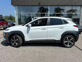 Hyundai Kona Ultimate | CARFAX | АВТОКРЕДИТ БЕЗ ПЪРВОНАЧАЛНА , снимка 3