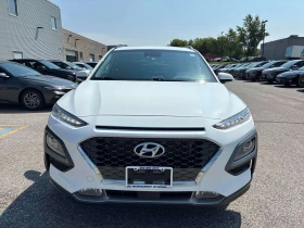 Hyundai Kona Ultimate | CARFAX | АВТОКРЕДИТ БЕЗ ПЪРВОНАЧАЛНА , снимка 2