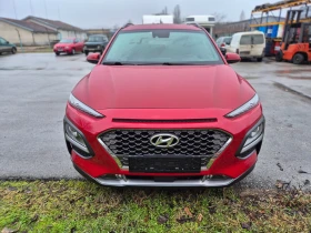 Hyundai Kona 1.6TGI - 16616 € / 32498.07 лв. - 80139422 10