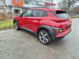 Hyundai Kona 1.6TGI - 16616 € / 32498.07 лв. - 80139422 5