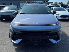 Hyundai Kona  N Line / Carfax / Автокредит , снимка 6