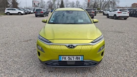 Hyundai Kona СЪДЕЙСТВИЕ ЗА ПРОВЕРКА НА СЪСТ В СЕРВИЗ НА HYUNDAI - 16400 € / 32075.61 лв. - 85766353 3
